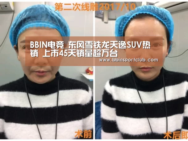 BBIN电竞_东风雪铁龙天逸SUV热销 上市45天销量超万台(图3) BBIN棋牌